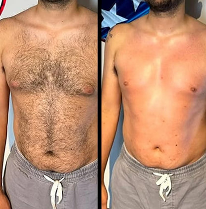 Original Permanent Hair Removal Spray
