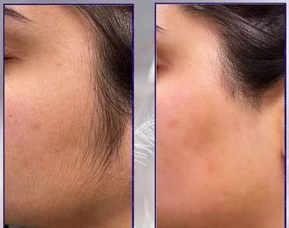 Original Permanent Hair Removal Spray