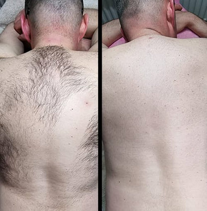 Original Permanent Hair Removal Spray