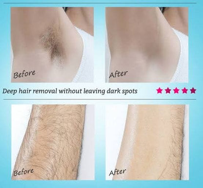 Original Permanent Hair Removal Spray